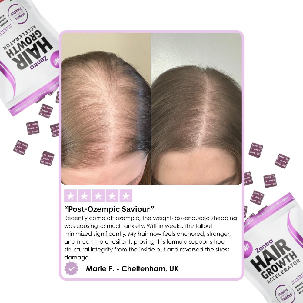 Hair Growth Accelerator Soft Chews