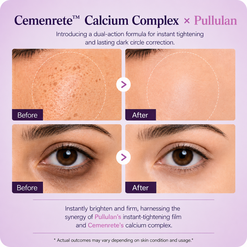 Zentra Calcium Dark Under-Eye Cream
