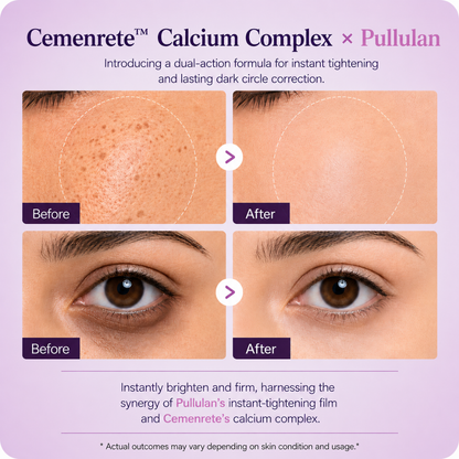 Zentra Calcium Dark Under-Eye Cream