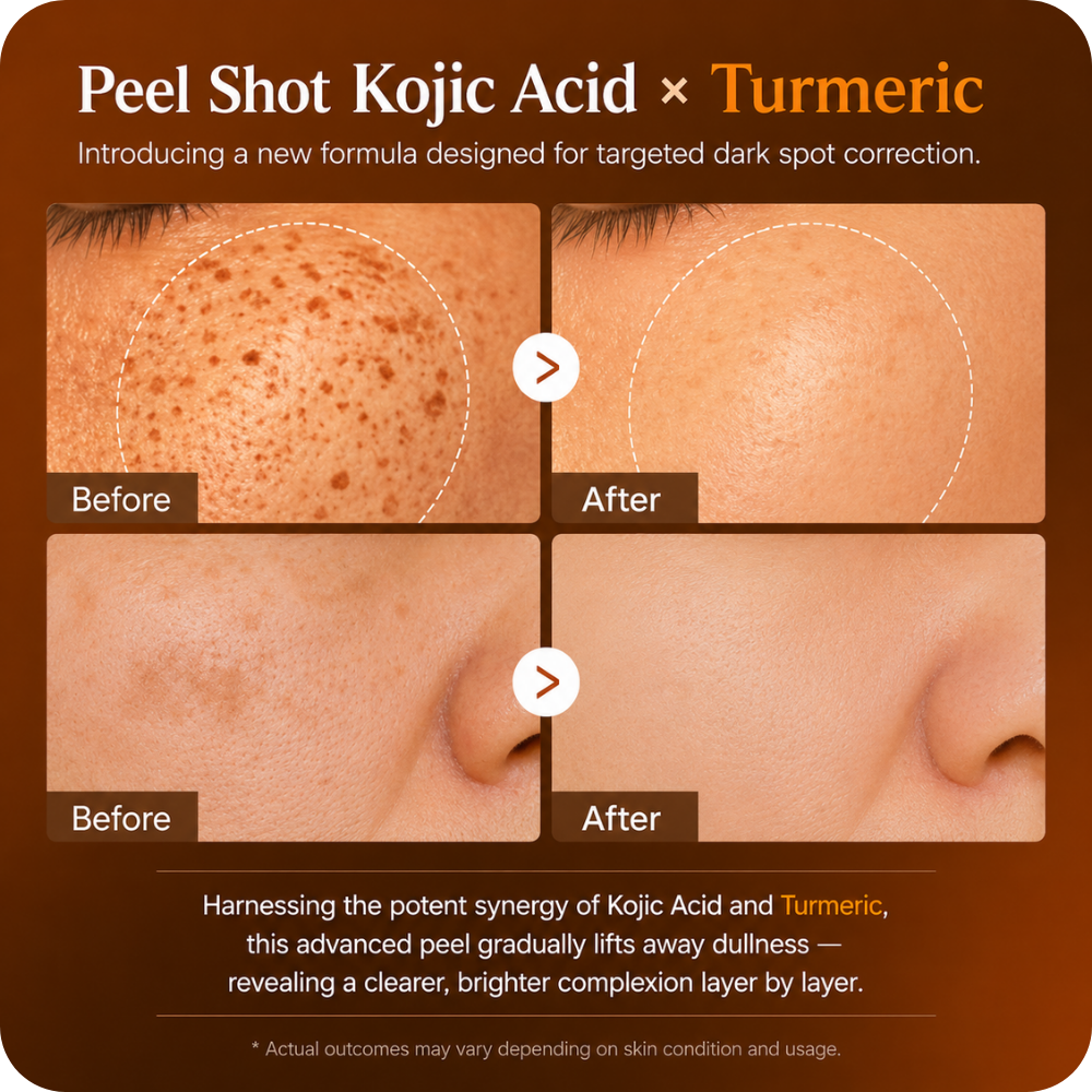 Zentra - Kojic Acid Exfoliating Peel Shot