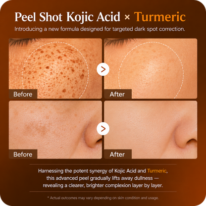 Zentra - Kojic Acid Exfoliating Peel Shot